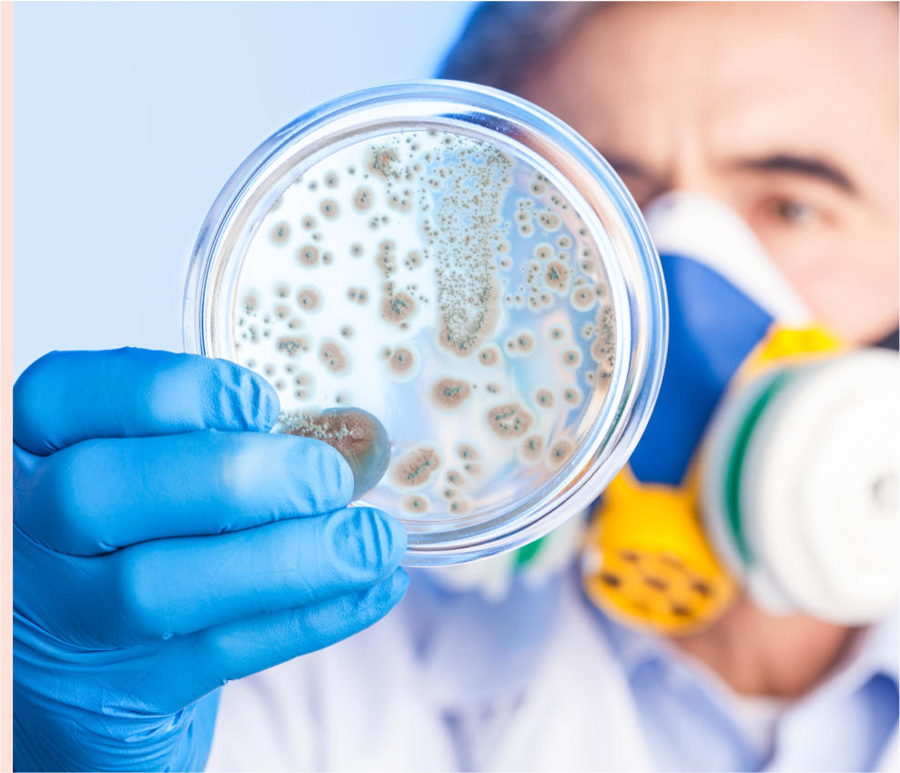 Prokaryotic Transcriptome Analysis